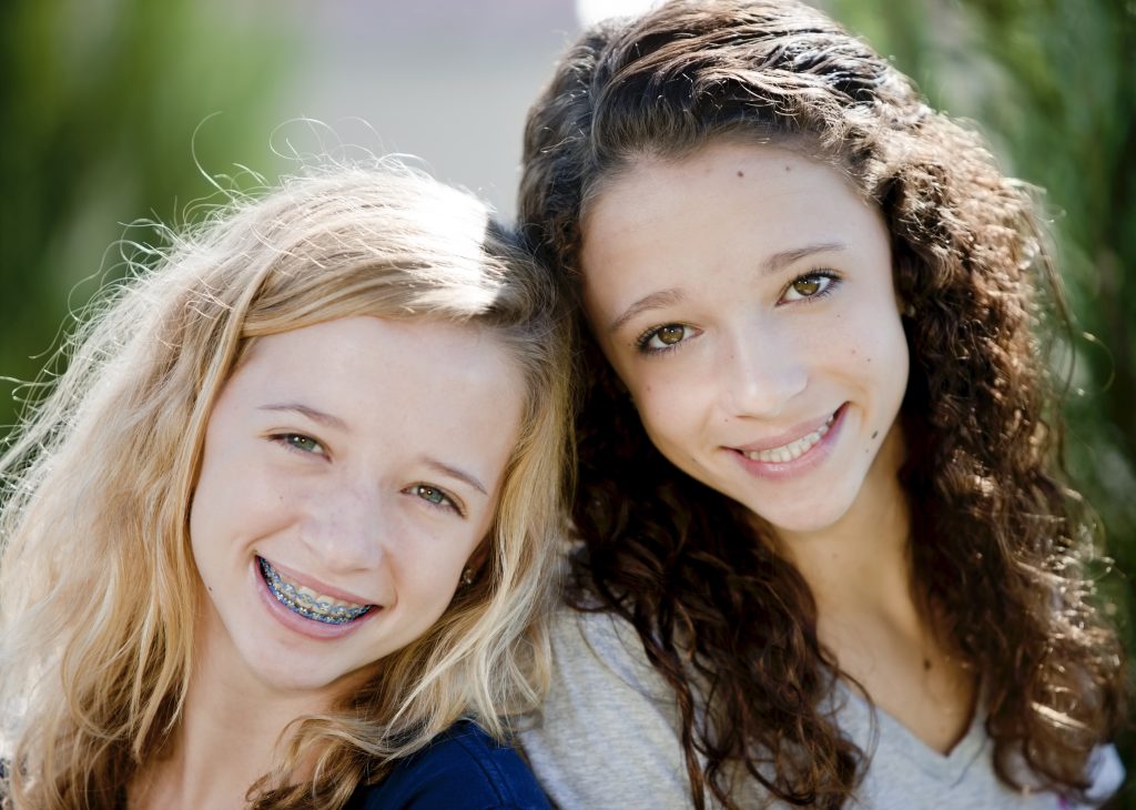 Clear cosmetic braces on front teeth in Milton Ontario