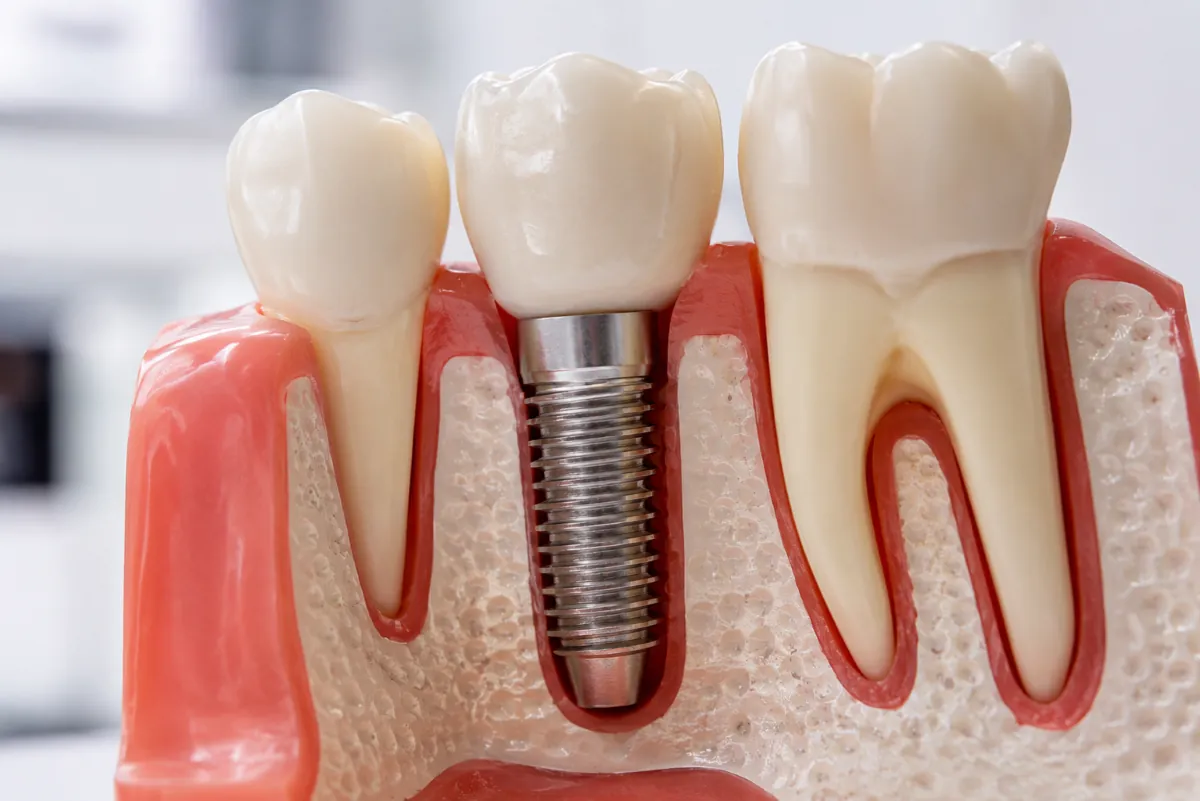 Restorative Dentistry