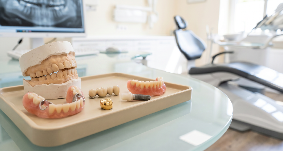 Full Mouth Rehabilitation in Milton, Treatment Options Overview | White Dove Dental Full mouth rehabilitation in Milton treatment options, dental models, bridge, crown, denture, and implant displayed in a clinical setting